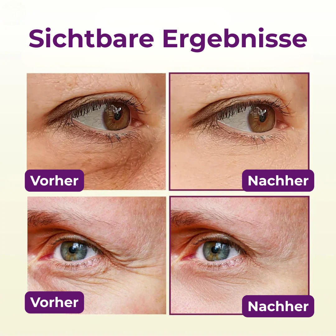 VitaGlow™ – für eine straffere Haut