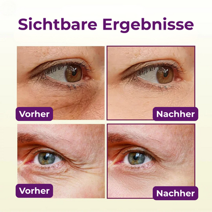 VitaGlow™ – für eine straffere Haut